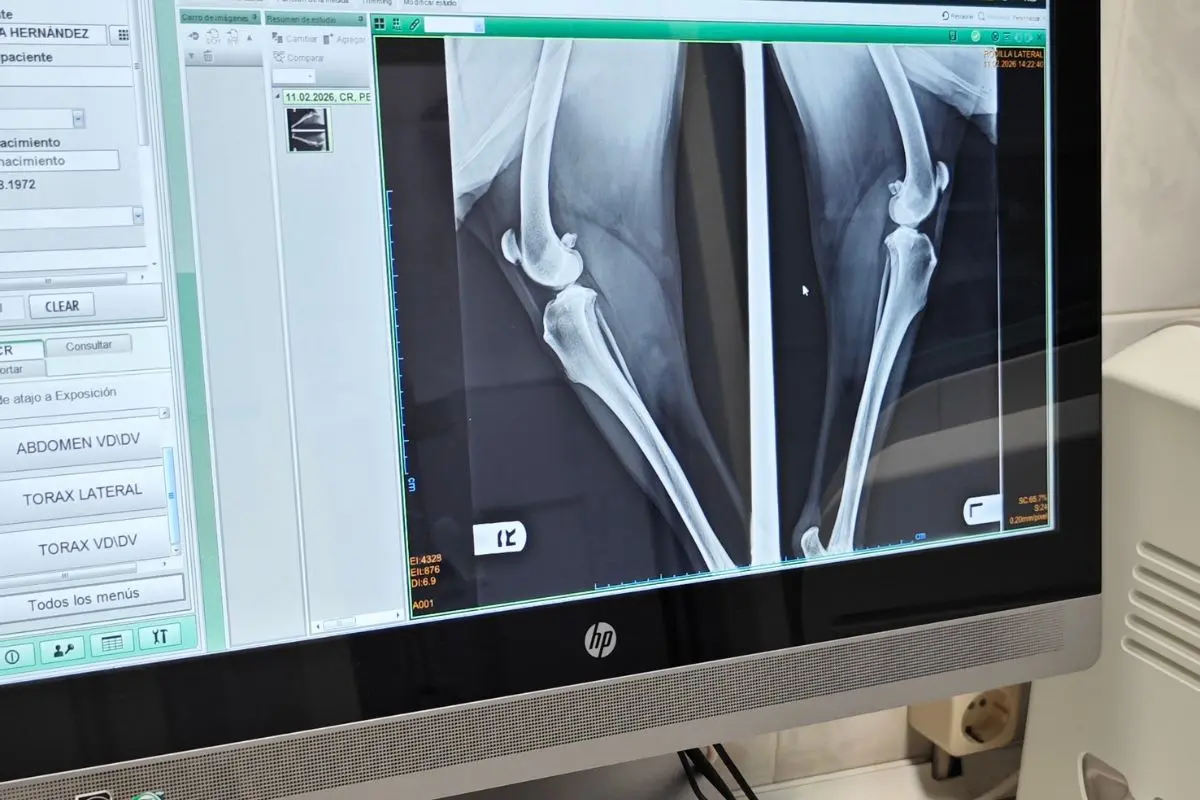 Tecnología de radiodiagnóstico